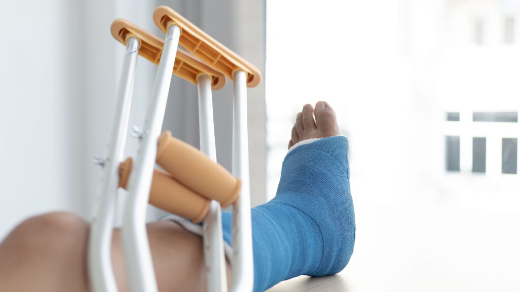 Zdejmujemy gips i co dalej? Dlaczego rehabilitacja po złamaniu jest kluczowa?